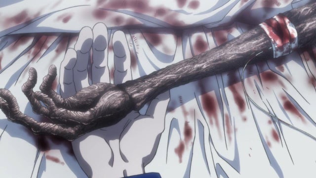 gon arm Is Gon Freecs Dead in Hunter x Hunter?