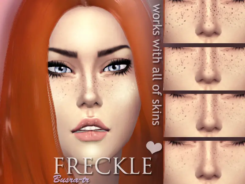 8. FreckleX