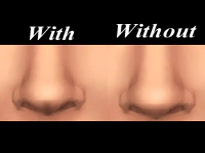 nose dimples sims mod