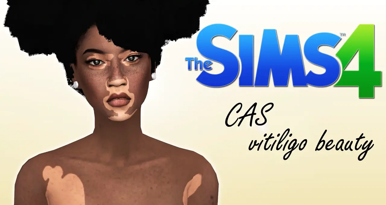 15 Best Sims 4 Viltiligo CC Mods