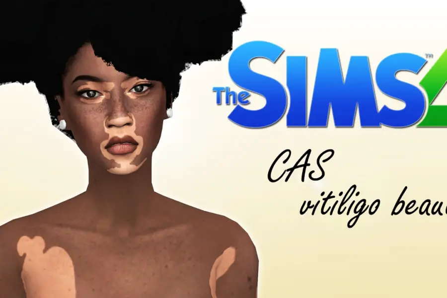 15 Best Sims 4 Viltiligo CC Mods